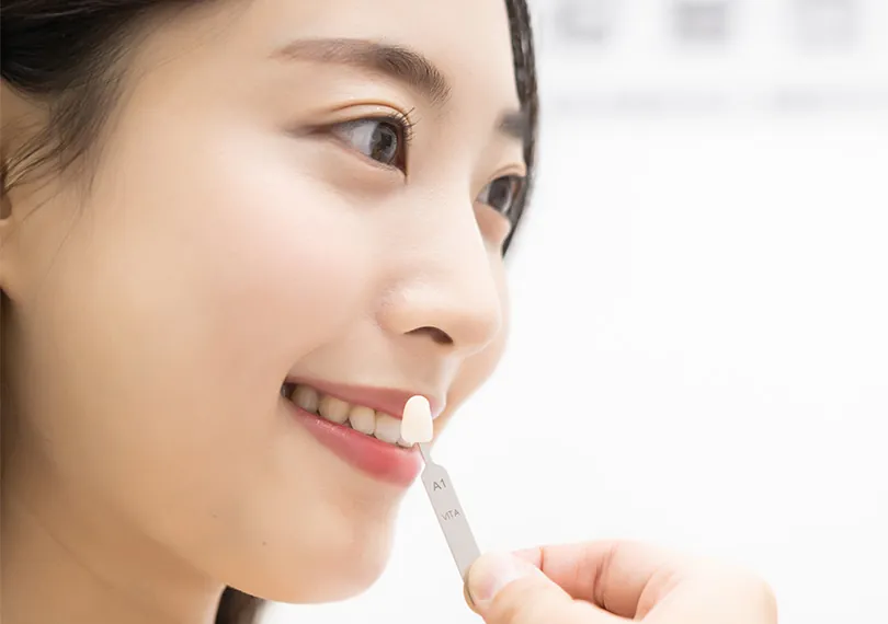 무삭제 라미네이트 (No-Prep Laminate) — 치아 모양 · 크기 · 색상을 함께 고려한 개인 맞춤 설계